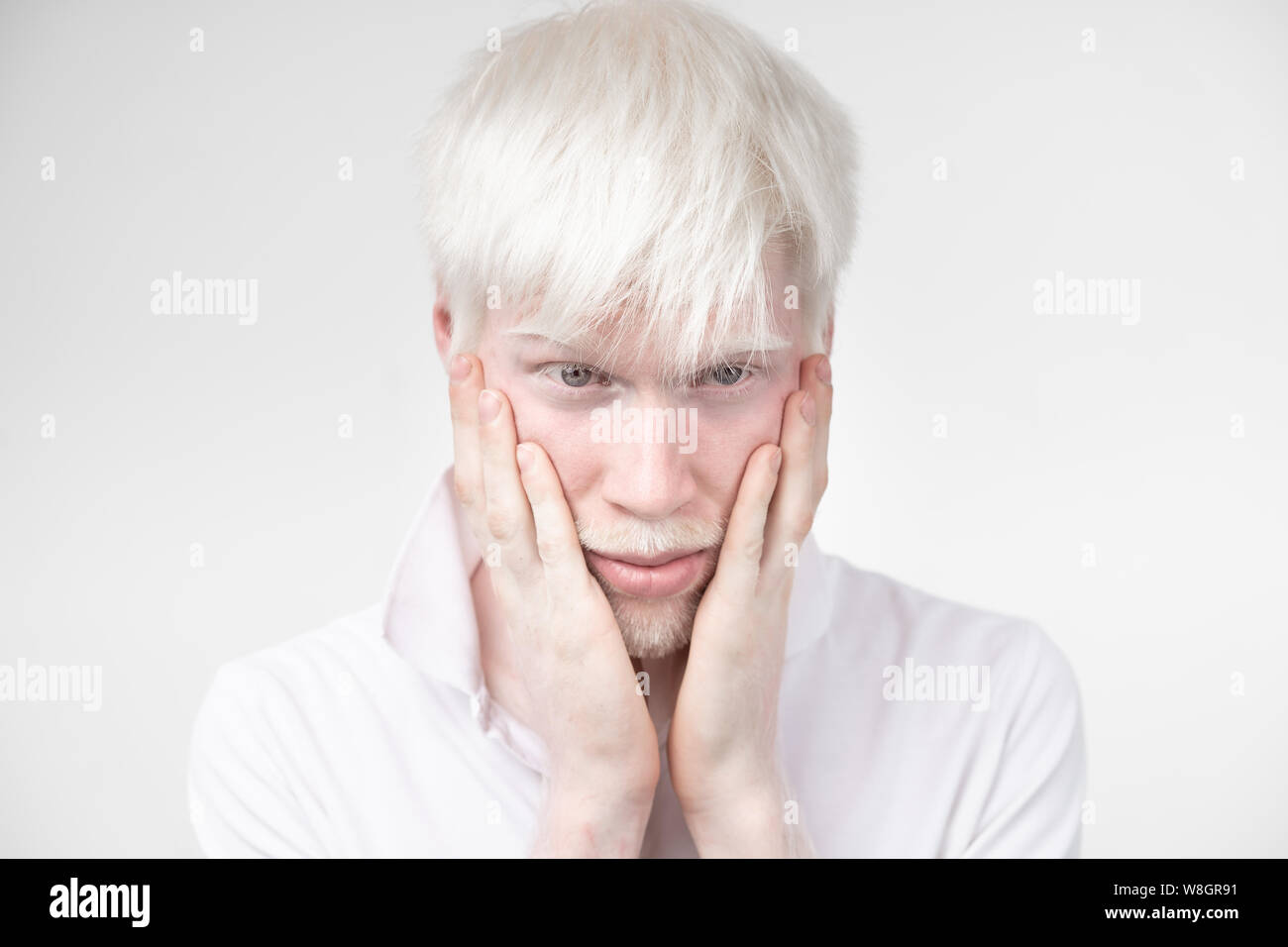 Portrait d'un homme albinos dans studio habillé t-shirt isolé sur un fond blanc. déviations anormales. Aspect insolite anomalie de la peau. Banque D'Images