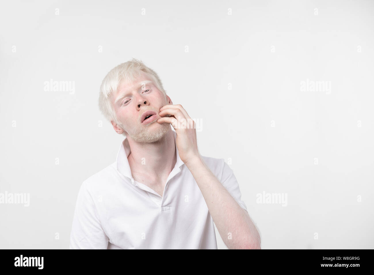 Portrait d'un homme albinos dans studio habillé t-shirt isolé sur un fond blanc. déviations anormales. Aspect insolite anomalie de la peau. Banque D'Images