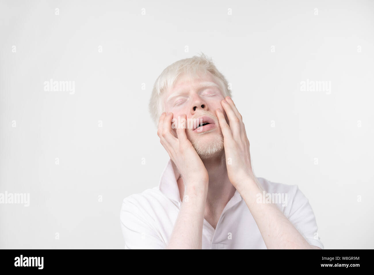 Portrait d'un homme albinos dans studio habillé t-shirt isolé sur un fond blanc. déviations anormales. Aspect insolite anomalie de la peau. Banque D'Images