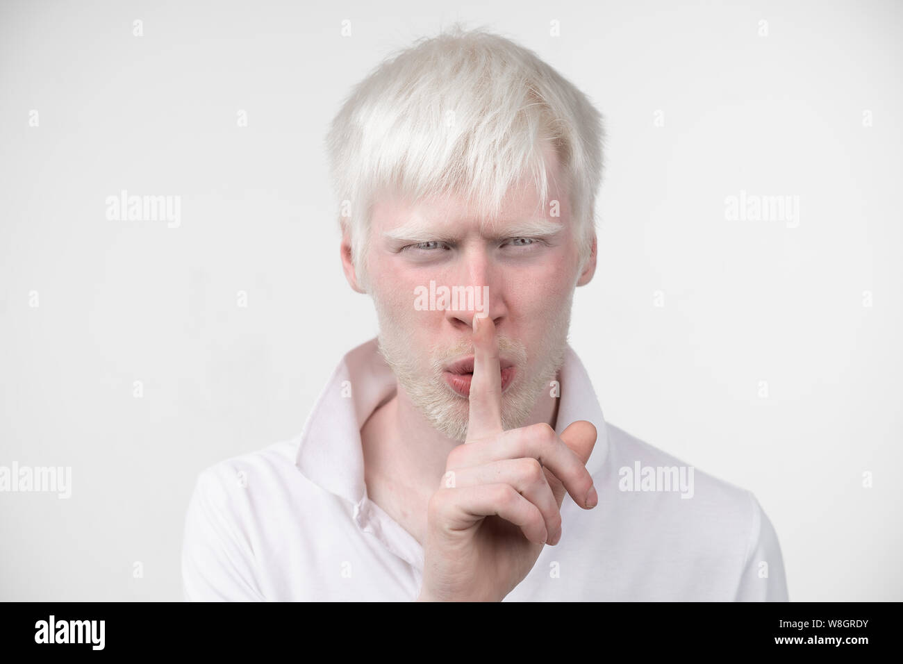 Portrait d'un homme albinos dans studio habillé t-shirt isolé sur un fond blanc. déviations anormales. Aspect insolite anomalie de la peau. Banque D'Images