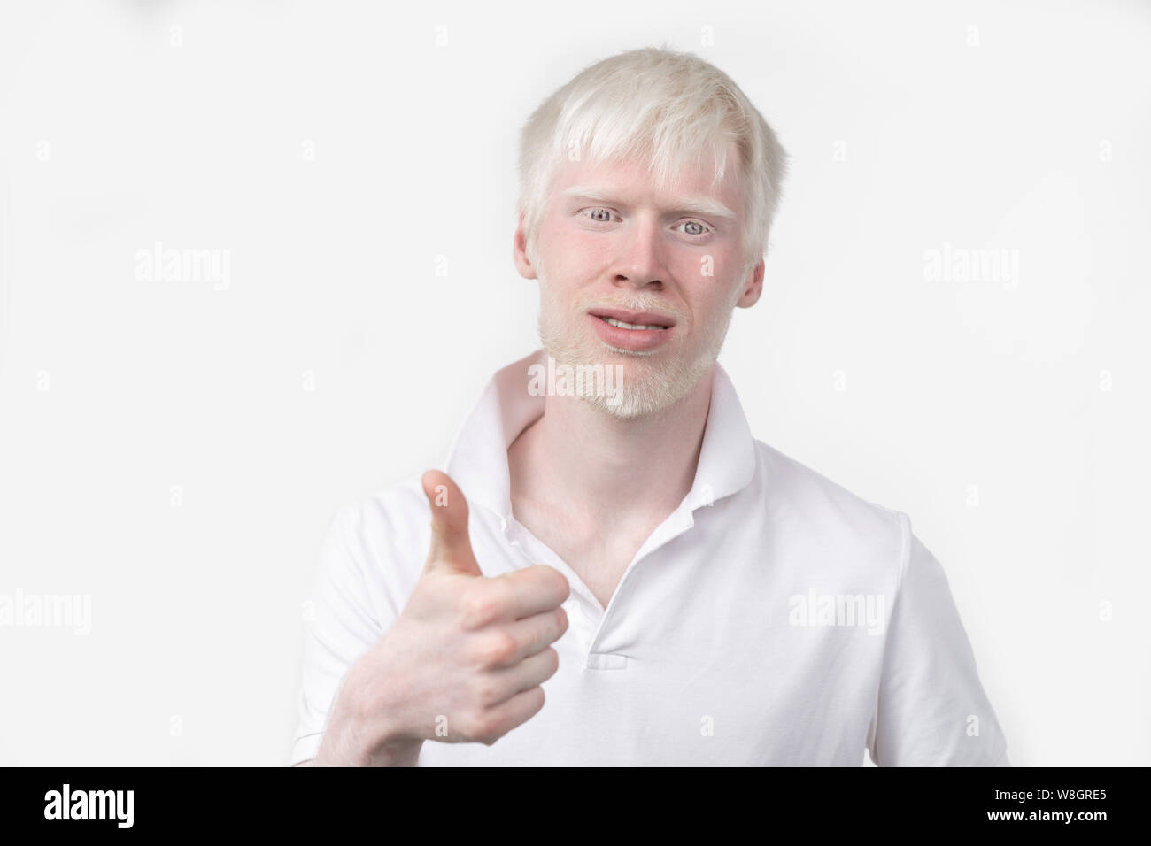 Portrait d'un homme albinos dans studio habillé t-shirt isolé sur un fond blanc. déviations anormales. Aspect insolite anomalie de la peau. Banque D'Images
