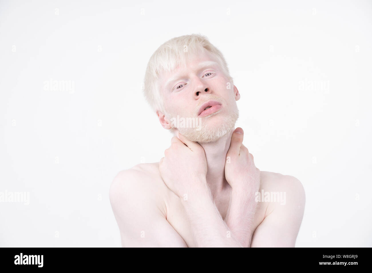 Portrait d'un homme albinos dans studio habillé t-shirt isolé sur un fond blanc. déviations anormales. Aspect insolite anomalie de la peau. Banque D'Images