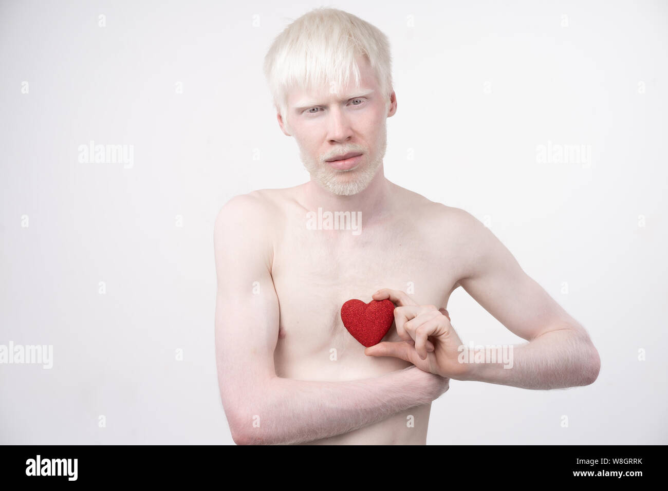 Portrait d'un homme albinos dans studio habillé t-shirt isolé sur un fond blanc. déviations anormales. Aspect insolite anomalie de la peau. Banque D'Images
