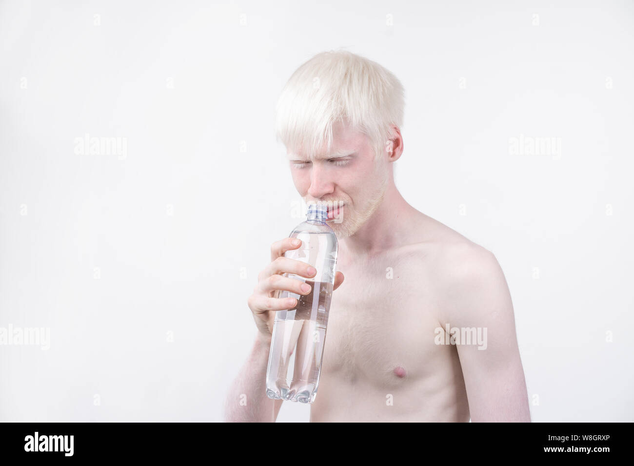 Portrait d'un homme albinos dans studio habillé t-shirt isolé sur un fond blanc. déviations anormales. Aspect insolite anomalie de la peau. Banque D'Images