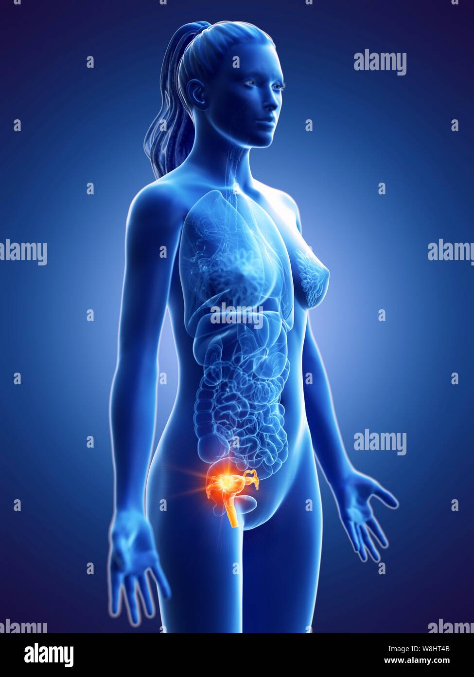 Cancer de l'utérus, ordinateur conceptuel illustration. Banque D'Images