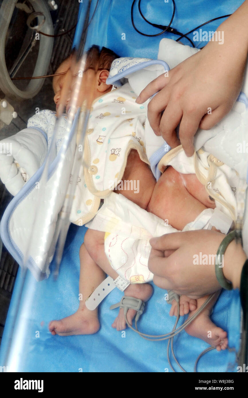 Un travailleur de la médecine chinoise s'occupe de l'uni des soeurs jumelles dans un incubateur dans une ambulance avant qu'ils ont été transférés à l'Hôpital pour enfants Banque D'Images