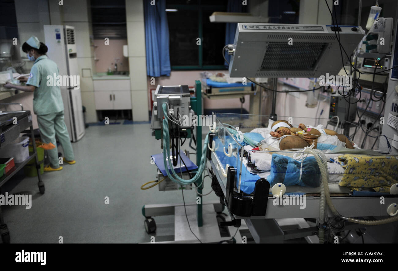 Une paire de jumeaux siamois nouveau-né reçoit un traitement médical en soins intensifs à l'Hôpital pour enfants du Hunan à Changsha city, Hunan province Chines centrale, 5 septembre Banque D'Images