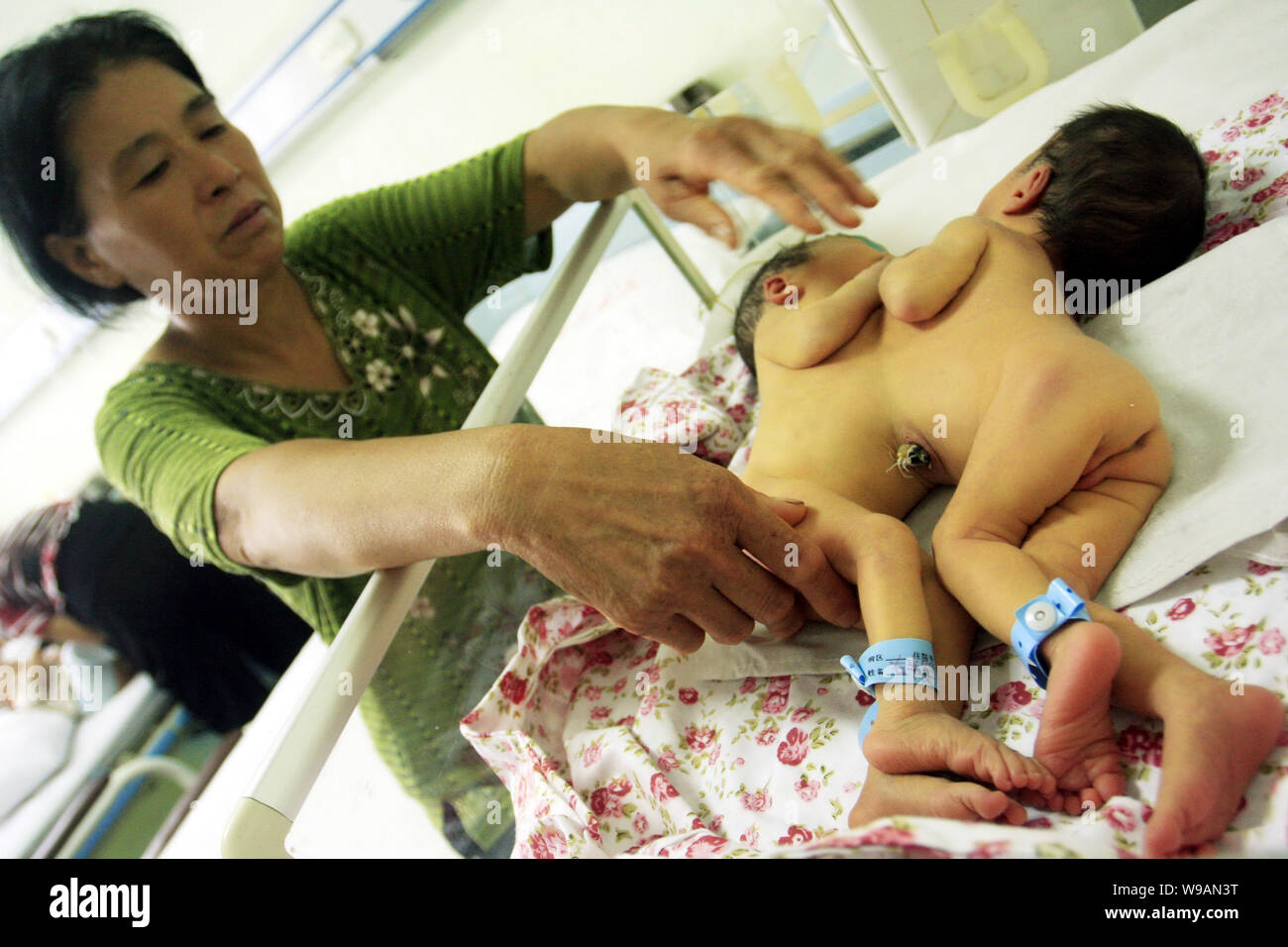 Une paire de jumelles de conjoined nouveau-né sont suivis par leur grand-mère à l'hôpital provincial de Shandong à Jinan City, Shandong Chines est provi Banque D'Images