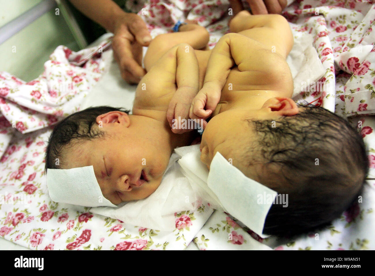 Une paire de jumelles de conjoined nouveau-né sont suivis par leur grand-mère à l'hôpital provincial de Shandong à Jinan City, Shandong Chines est provi Banque D'Images