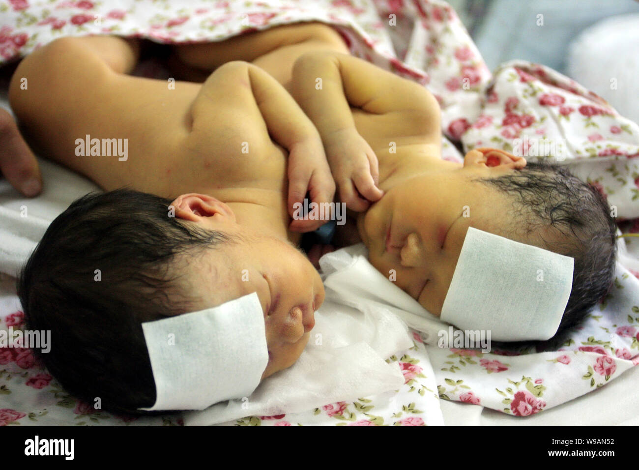 Une paire de jumelles de conjoined nouveau-né le sommeil à l'hôpital provincial de Shandong à Jinan City, Shandong province, Chines est 7 septembre 2010. L Banque D'Images