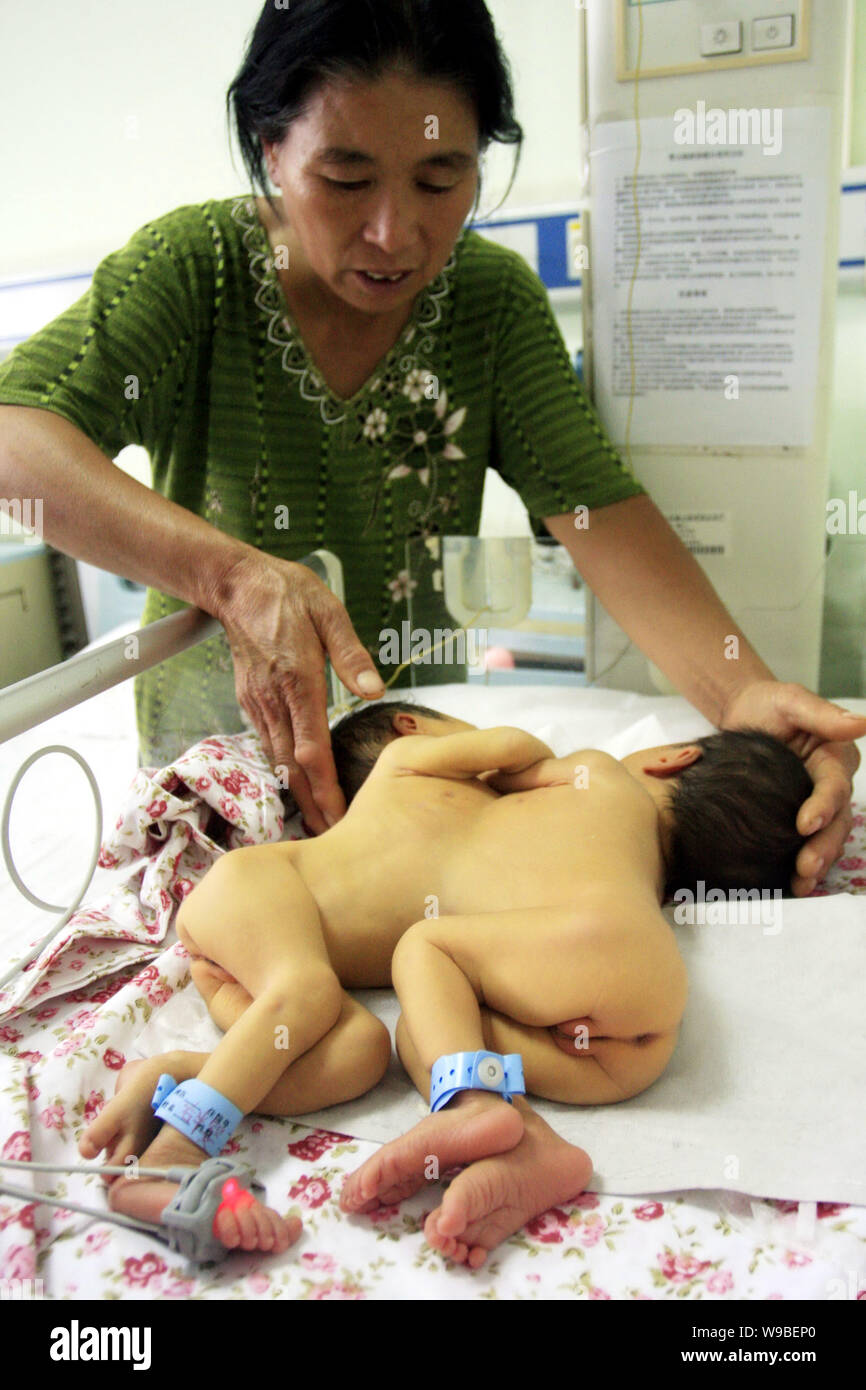 Une paire de jumelles de conjoined nouveau-né sont suivis par leur grand-mère à l'hôpital provincial de Shandong à Jinan City, Shandong Chines est provi Banque D'Images