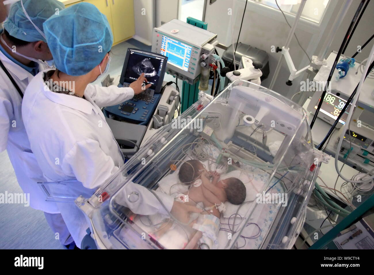 Les médecins chinois examiner le nouveau-né des soeurs jumelles siamoises conservés dans un incubateur à l'Hôpital pour enfants de Bayi de Beijing, Chine, le jeudi, 13 août 20 Banque D'Images