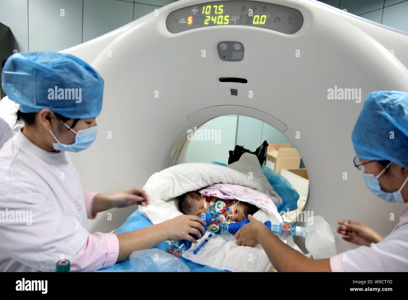 Les infirmières aident le nouveau-né chinois deux sœurs siamoises de respirer tandis que les jumeaux ont reçu l'examen par tomodensitométrie à l'Hôpital pour enfants de Bayi à Bei Banque D'Images