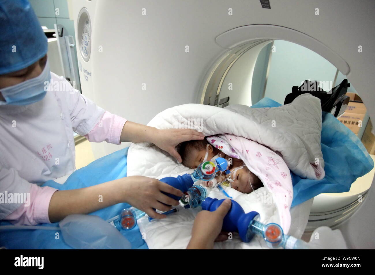 Les infirmières aident le nouveau-né chinois deux sœurs siamoises de respirer tandis que les jumeaux ont reçu l'examen par tomodensitométrie à l'Hôpital pour enfants de Bayi à Bei Banque D'Images