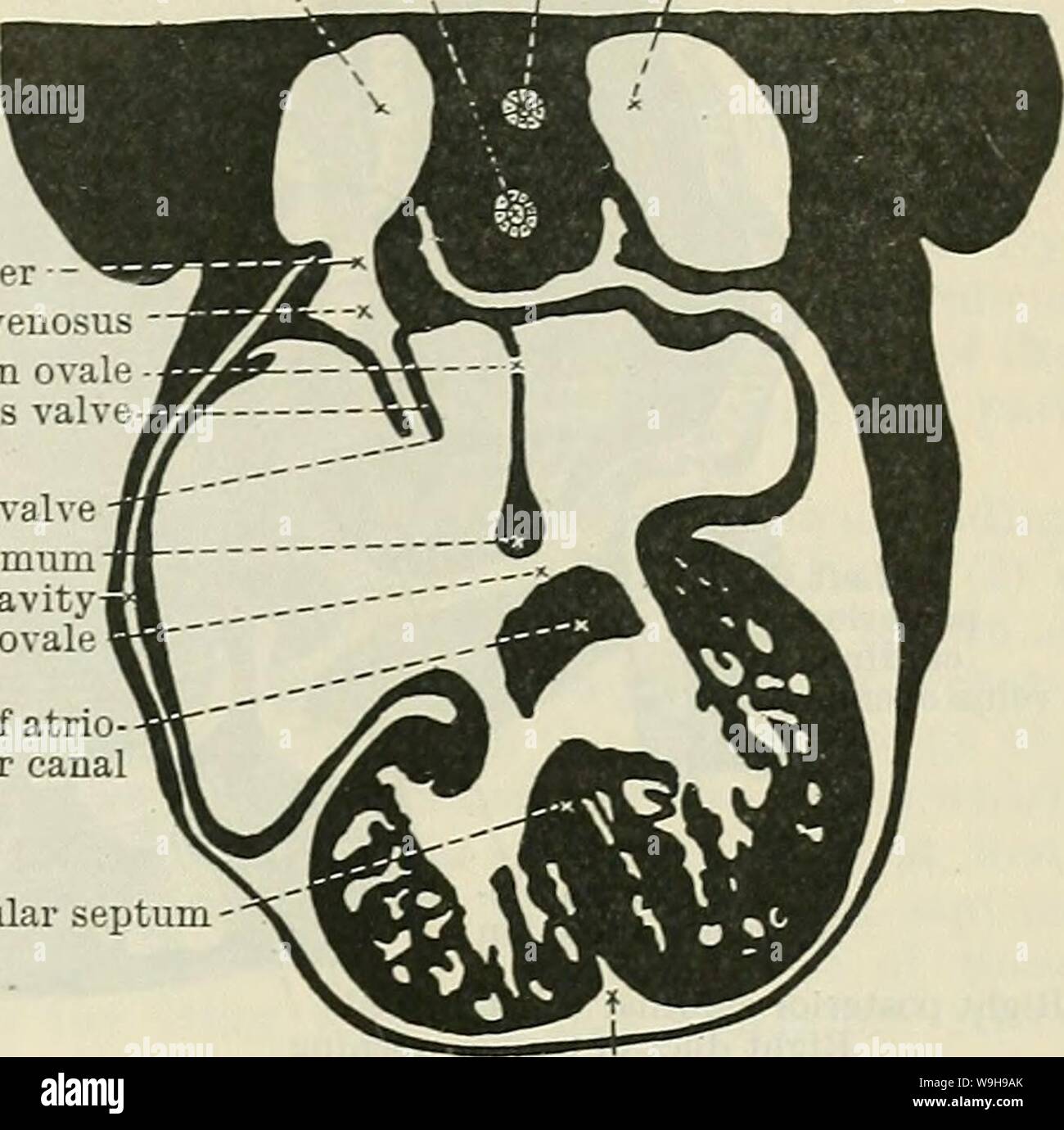 Image d'Archive de la page 1066 de Cunningham's Text-book d'anatomie (1914). Cunningham's Text-book d'anatomie cunninghamstextb00cunn Année : 1914 ( DÉVELOPPEMENT DE L'HEAET. 1033 Le canal atrioventriculaire.-Dans les premiers stades du canal atrio-ventriculaire s'ouvre à travers la paroi dorsale de la chambre ventriculaire vers le côté gauche, mais, comme le ventricule augmente de taille, l'ouverture d'atrio-ventriculaire se déplace vers la droite jusqu'à ce qu'il occupe la partie moyenne de la paroi dorsale du ventricule. Alors que le changement de position se produit la trachée (oesophage le canal atrio-ventriculaire jonction devient o Banque D'Images