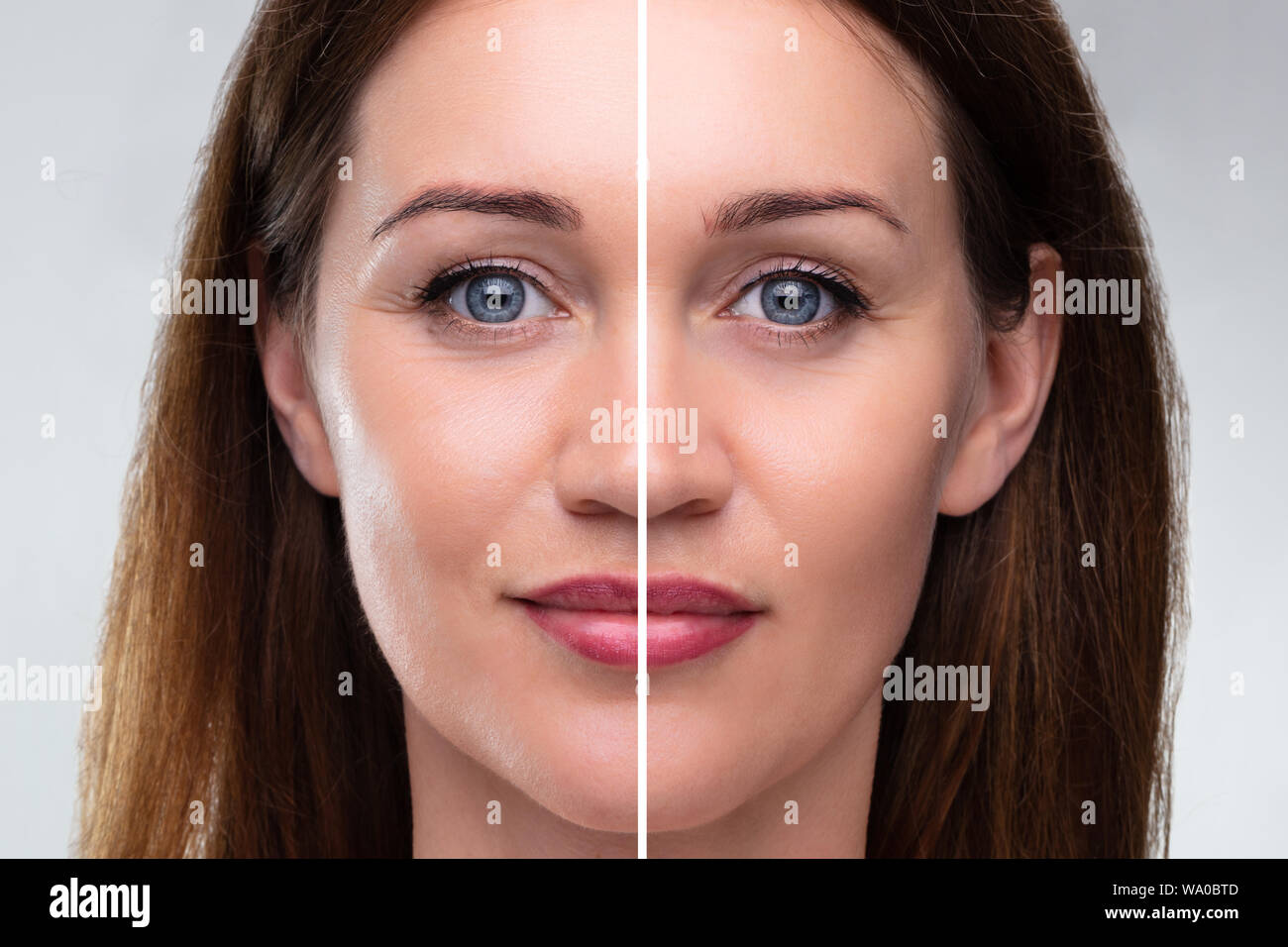 Close-up of a young woman's Face avant et après intervention cosmétique Banque D'Images