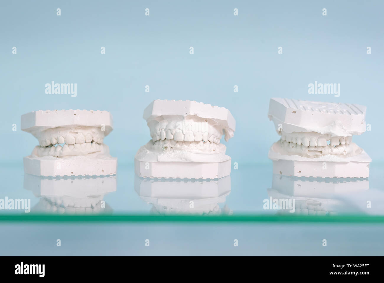 Des juifs de gypse différents modèle sur une étagère en verre au bureau de dentiste sur fond bleu clair. Laboratoire de prothèse dentaire et. Support de coulage Banque D'Images