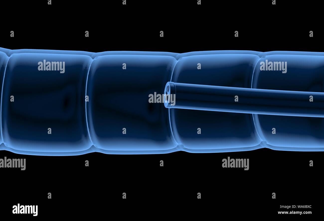 Technologie concept de coloscopie avec rendu 3d x-ray endoscope à l'intérieur de l'intestin Banque D'Images