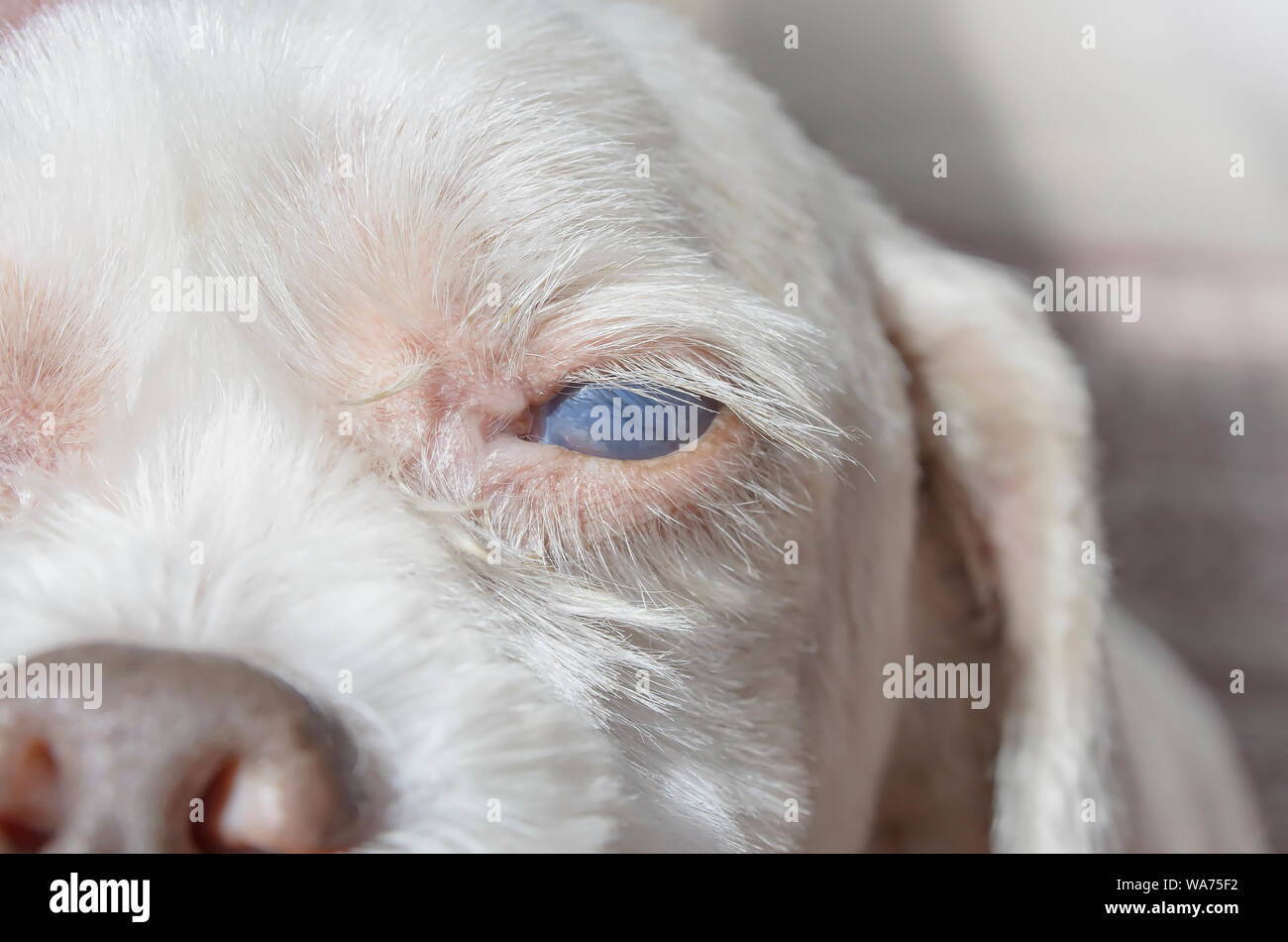 Maladie Des Yeux Photos Maladie Des Yeux Images Alamy