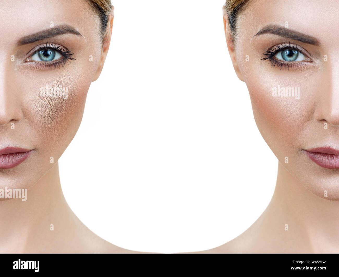 Visage de femme avant et après la procédure de l'hydrater. Traitement et soins de la peau. Banque D'Images