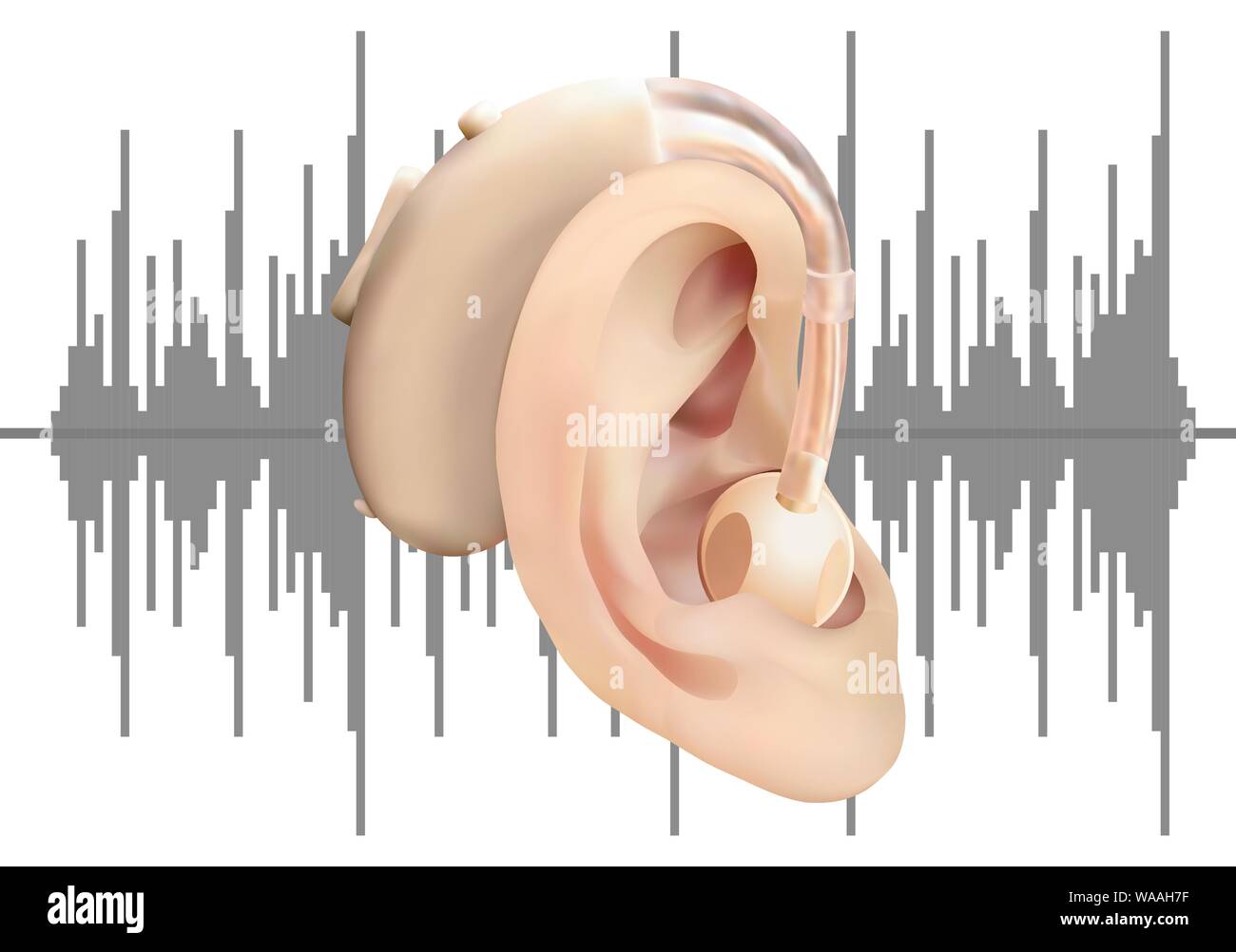 L'aide auditive numérique derrière l'oreille, sur l'arrière-plan d'onde  sonore diagramme. Le traitement de la perte auditive et des prothèses en  oto-rhino-laryngologie. Réaliste Image Vectorielle Stock - Alamy
