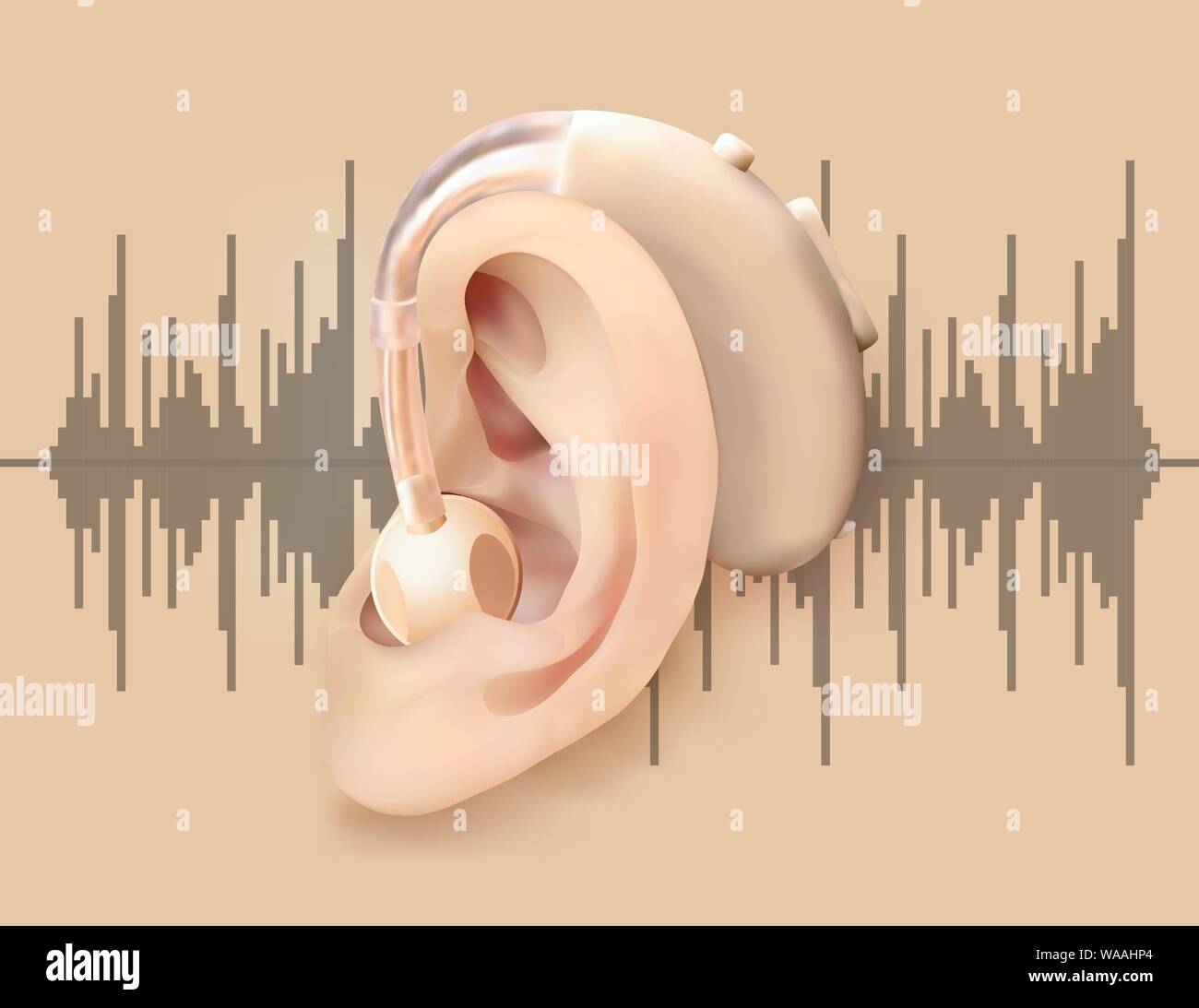 L'aide auditive numérique derrière l'oreille. Amplificateur de son et l' oreille sur fond d'onde sonore . Le traitement de la perte auditive et des  prothèses en oto-rhino-laryngologie Image Vectorielle Stock - Alamy