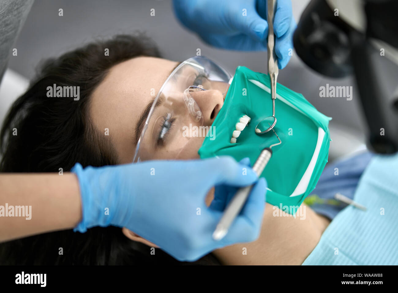 Lot De 10 Rétracteurs Dentaires En Forme De O - Latex/caoutchouc - Pour Blanchiment Des Dents