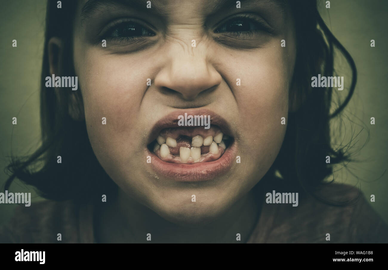 Portrait de jeune fille enfant sans dents de lait manquantes et les dents permanentes. Gros plan du jeune garçon avec des dents de plus en plus des lacunes et des dents permanentes et des gencives saines p Banque D'Images