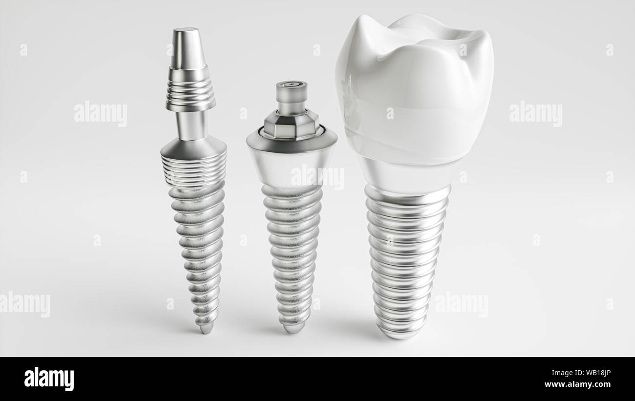 Trois implants différents sur fond blanc - rendu 3d Banque D'Images