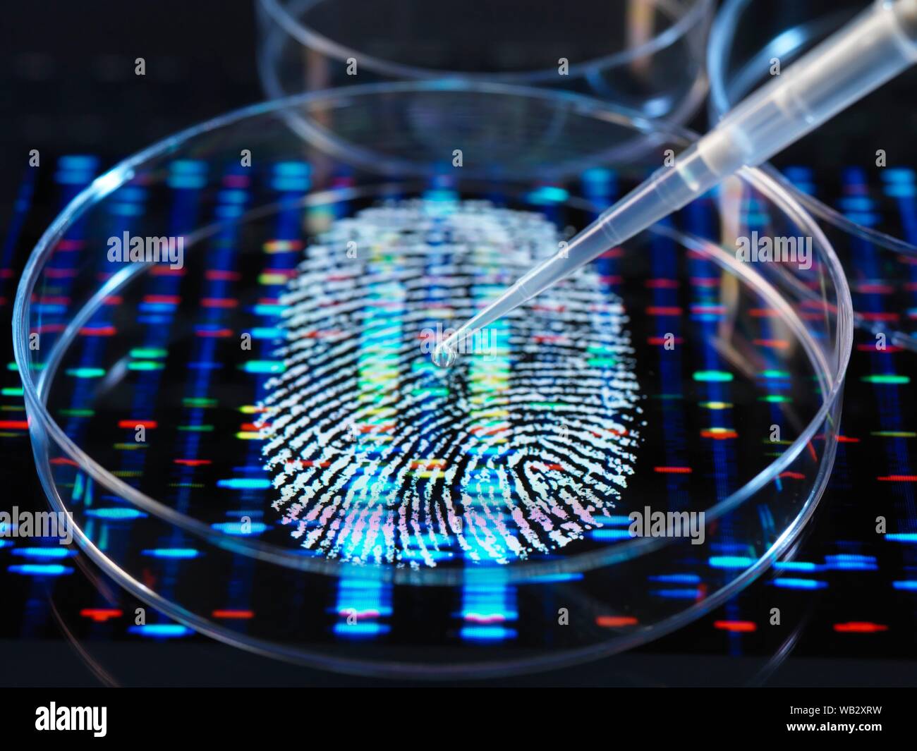 Conceptual image illustrant la recherche génétique. Un doigt humain imprimer avec un ADN (acide désoxyribonucléique) sous un profil de l'échantillon à la pipette dans une boîte de Petri. Banque D'Images