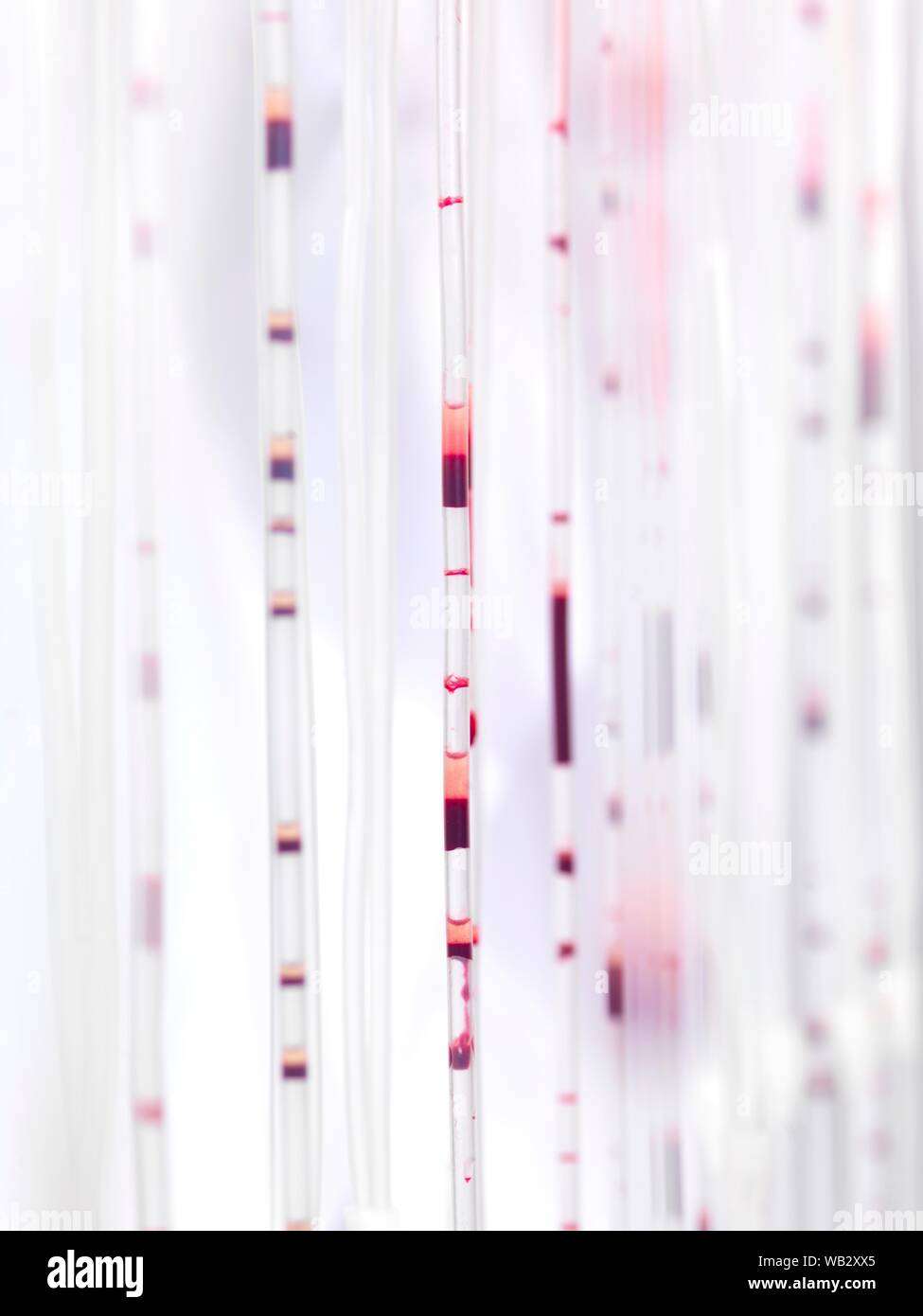 Tubes en passant par le sang au cours du traitement. Banque D'Images