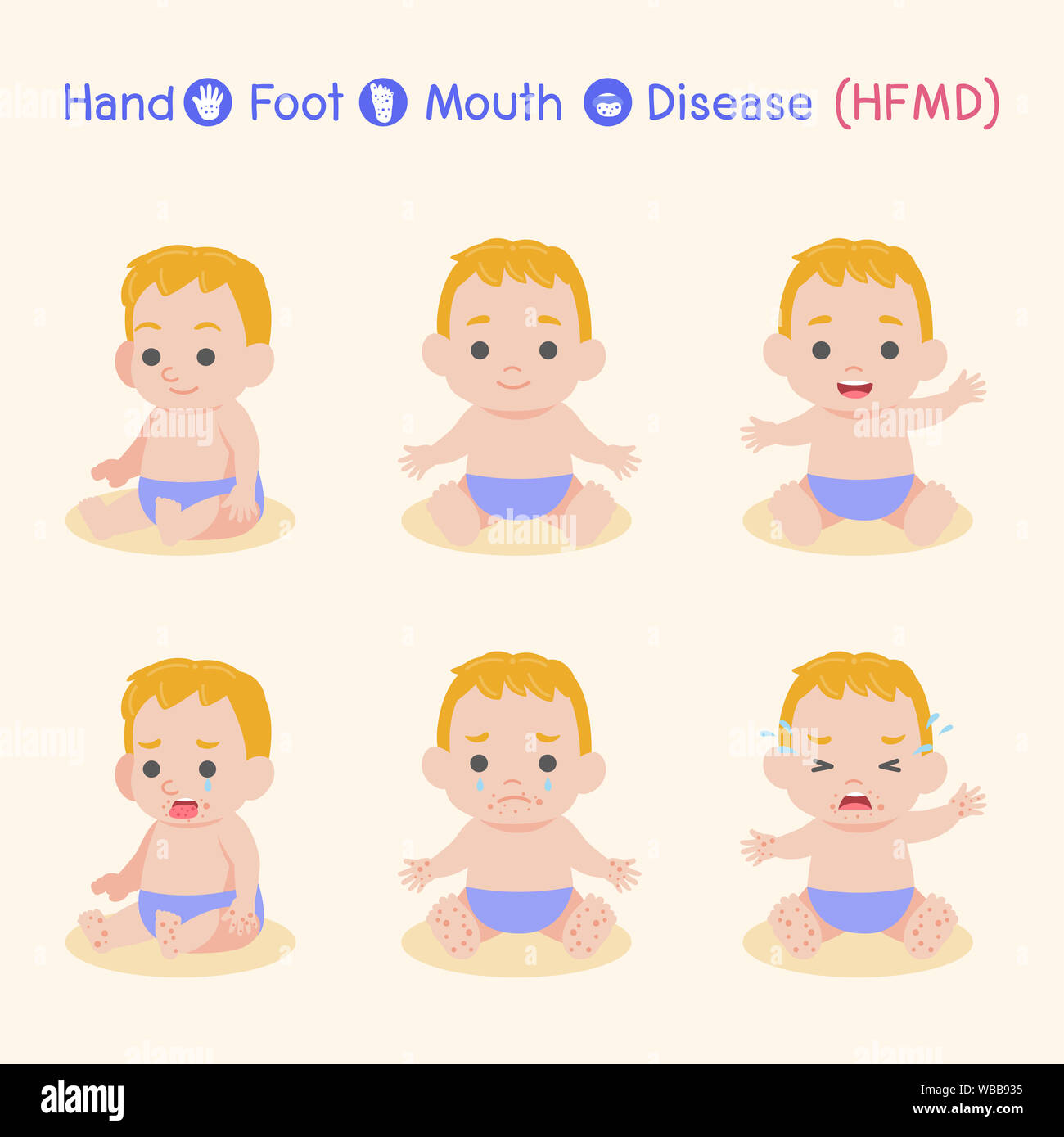 Jeu De Bebe Enfants Infectes Et Sains Garcon Ont Un Pied Main Bouche La Mmpb En Saison Des Pluies De Soins De Sante Medical Concept Personnage De Vec Photo Stock Alamy