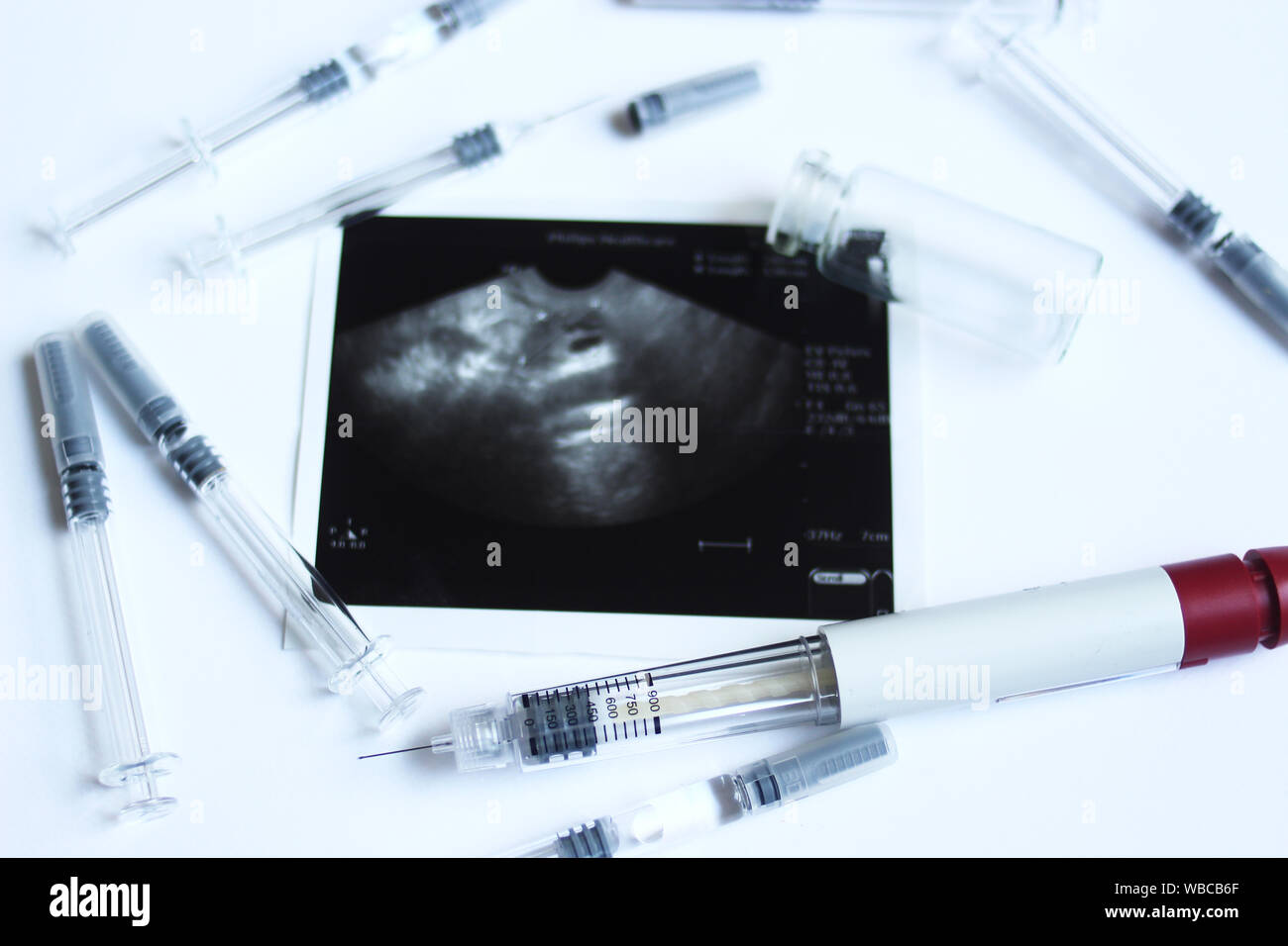 La technologie de reproduction assistée et de petites têtes d'injection seringues avec l'échographie ovarienne au milieu. La FIV et IIU médicaments thérapeutiques. Des médicaments pour Banque D'Images