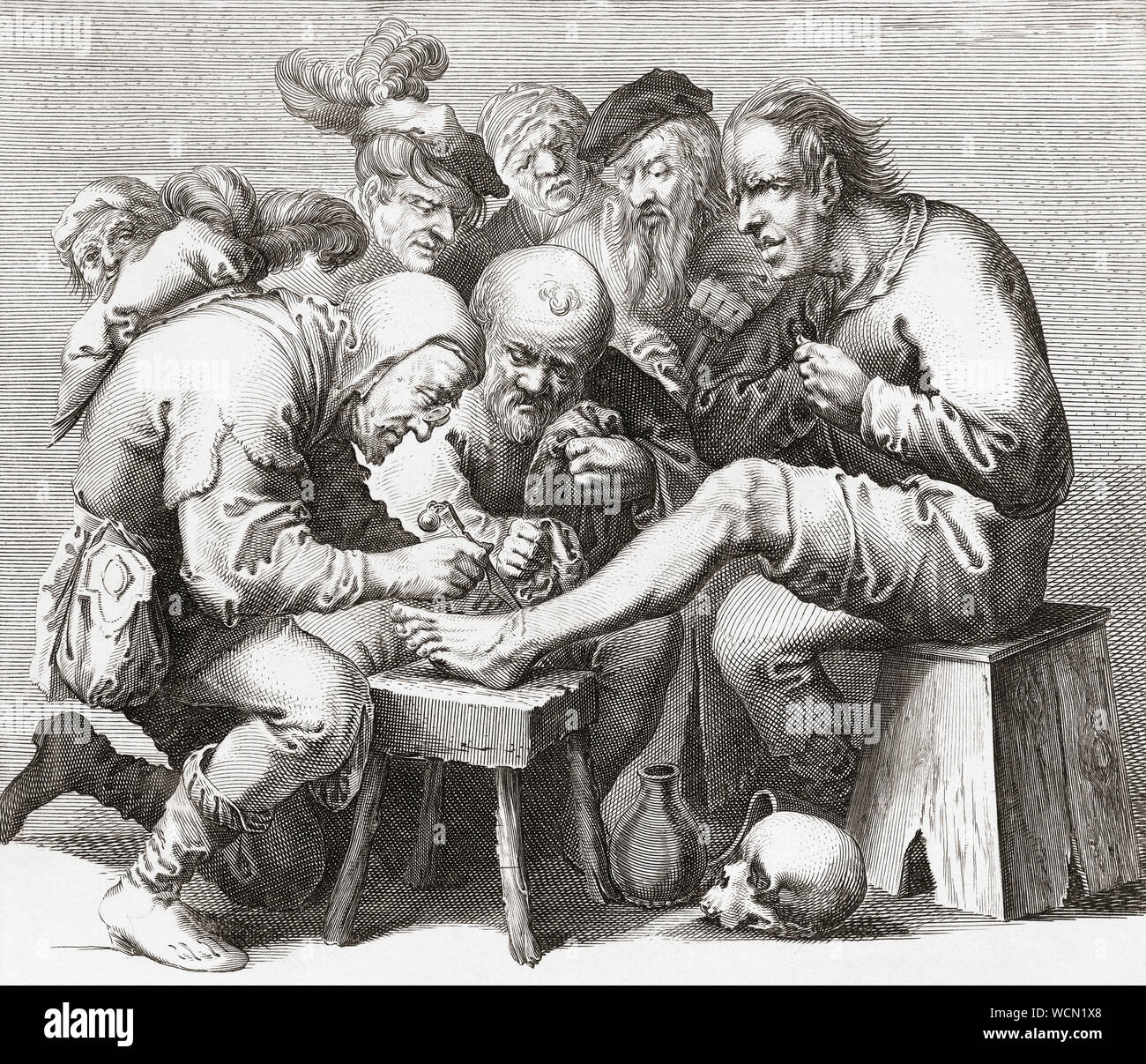 Au 17e siècle, un chirurgien chirurgie sur un pied d'homme. Après un travail du 17ème siècle. Banque D'Images