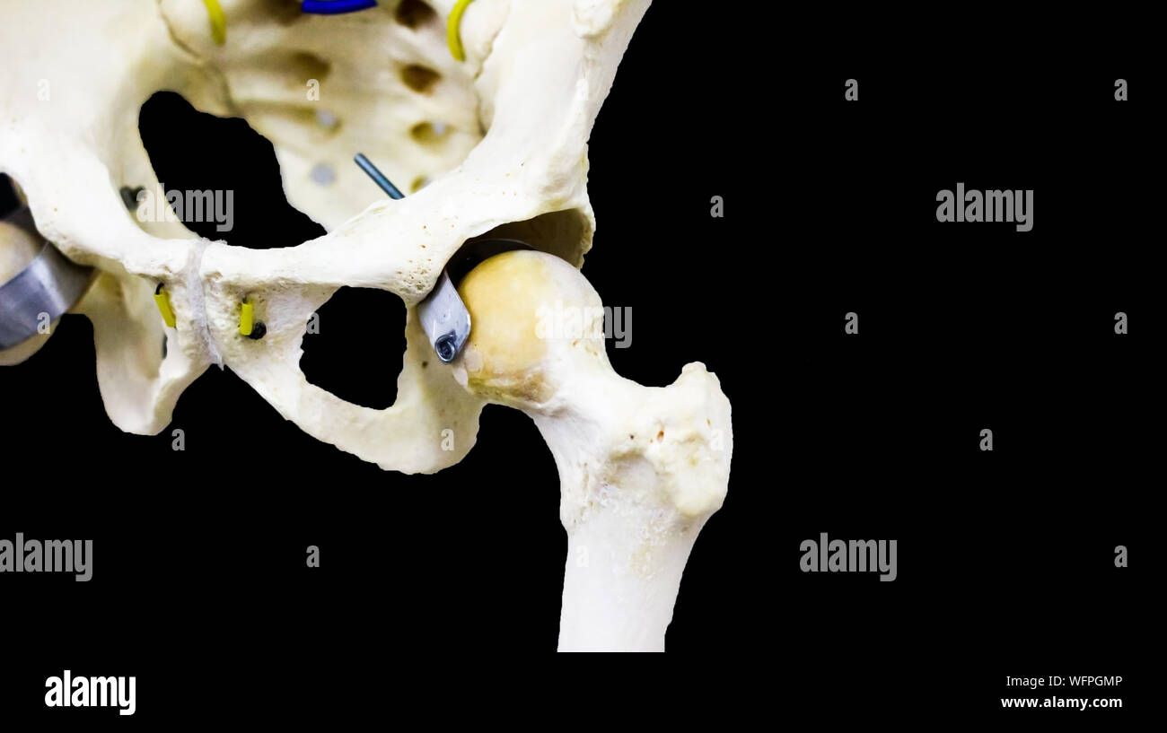 Photographie de la hanche articulée en fond noir Banque D'Images