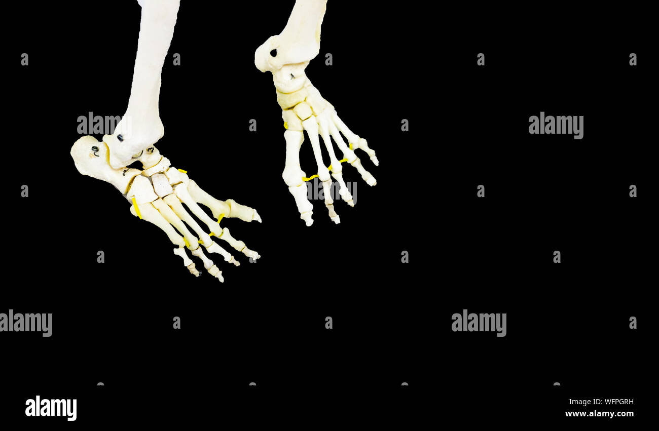 Photographie de jambe articulée bilatérales joint en fond noir Banque D'Images