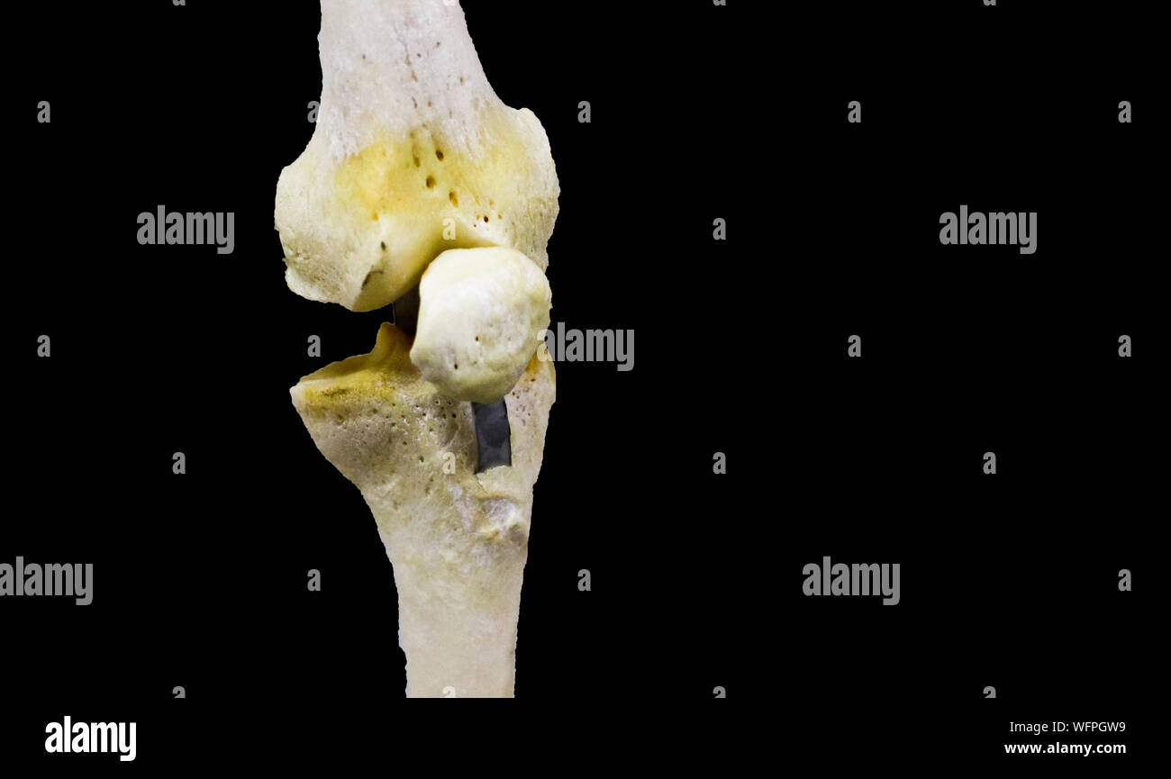 Photographie de l'articulation du genou articulé en fond noir Banque D'Images