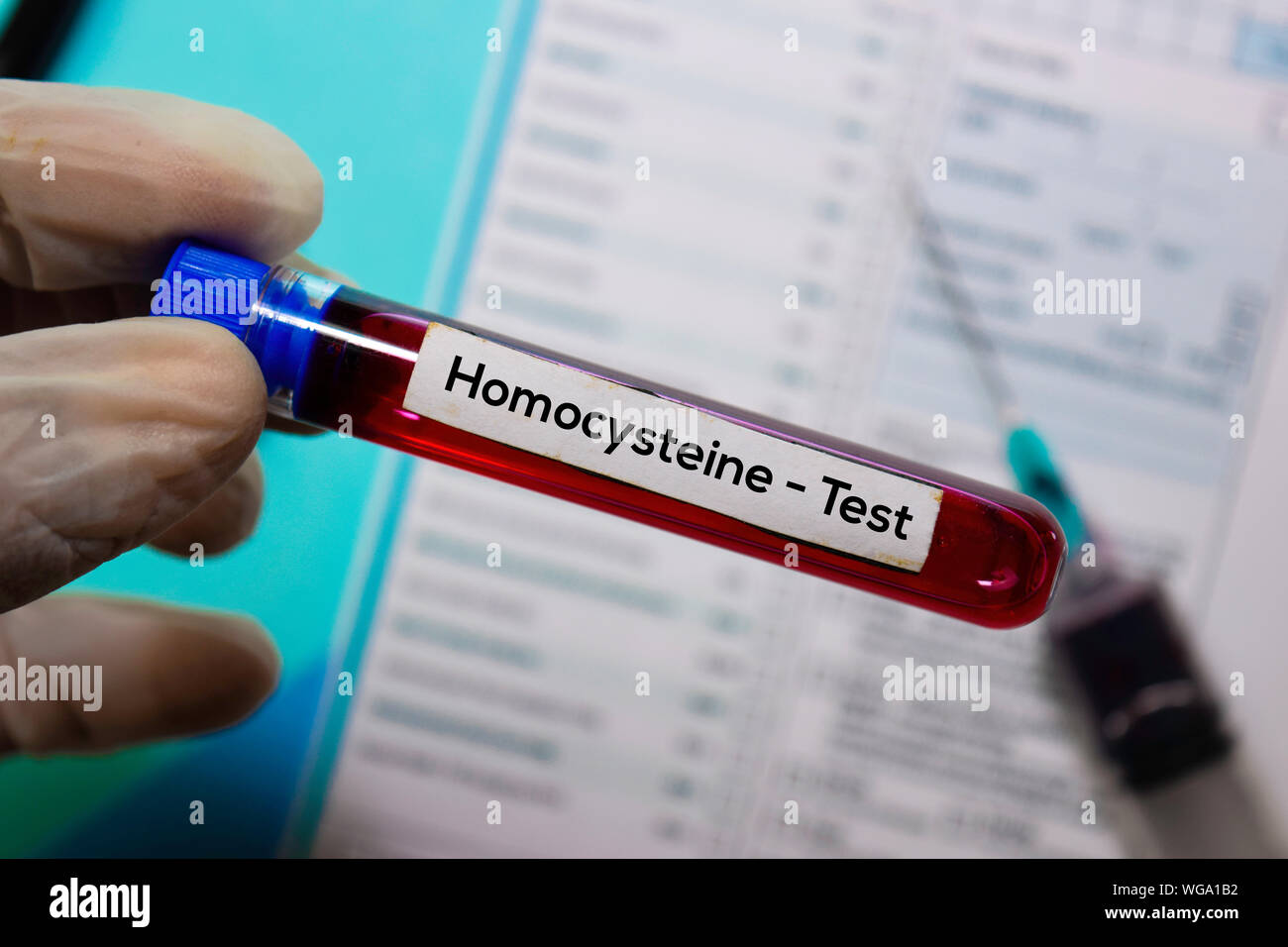 - Test d'homocystéine avec échantillon de sang. Vue de dessus de bureau isolé sur 24. Concept de soins santé/médecine Banque D'Images