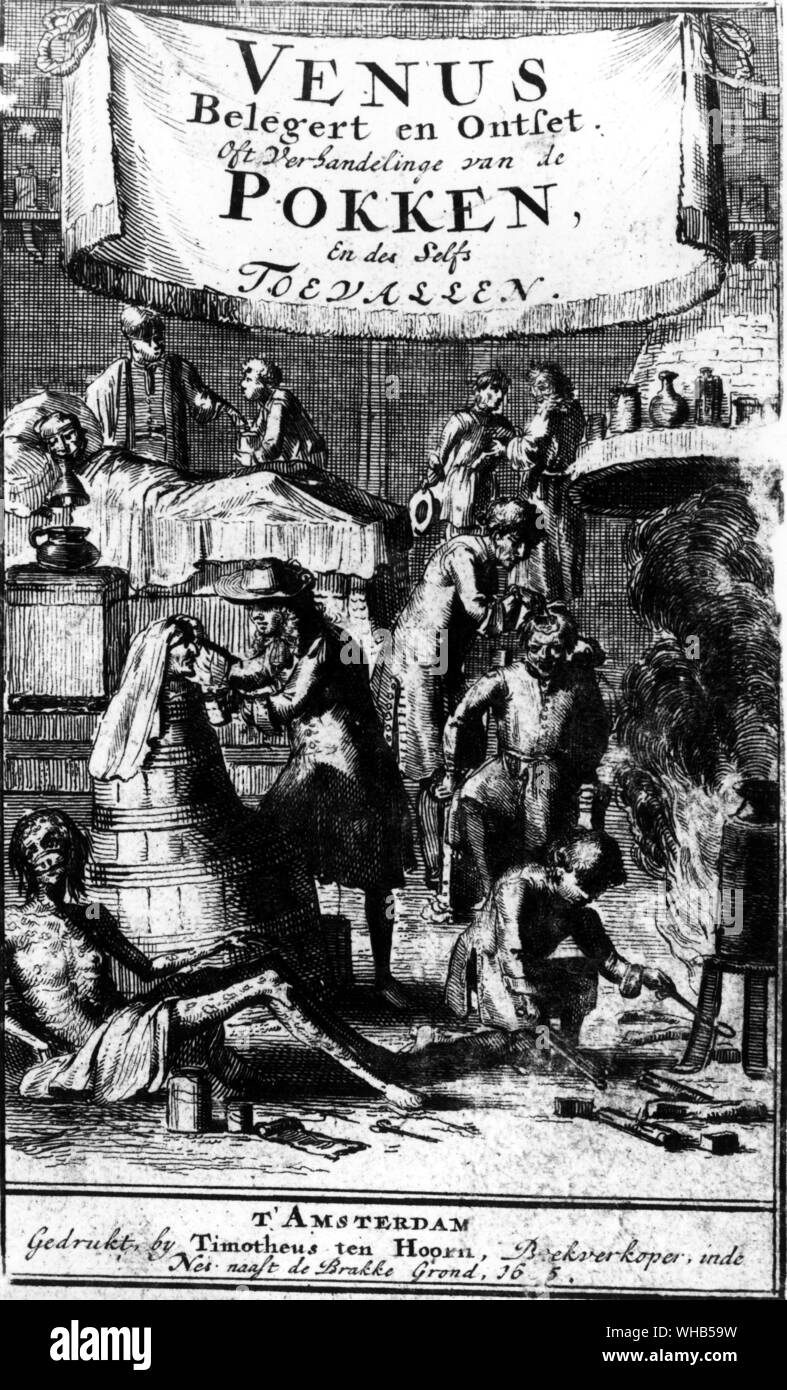 La varicelle - le traitement des maladies vénériennes par inunctions et inhalations Banque D'Images