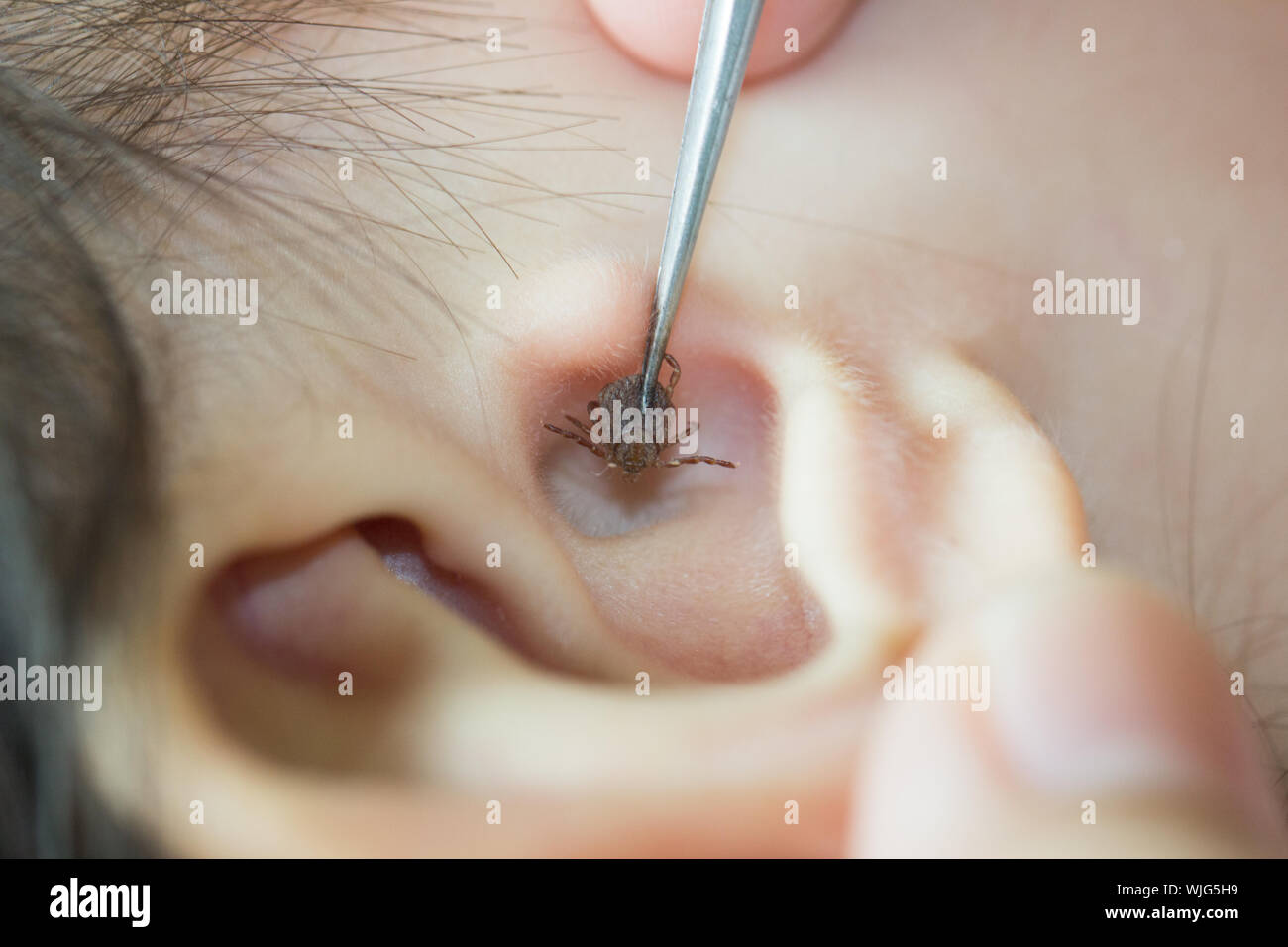 Close-up d'insecte dans l'oreille Photo Stock - Alamy