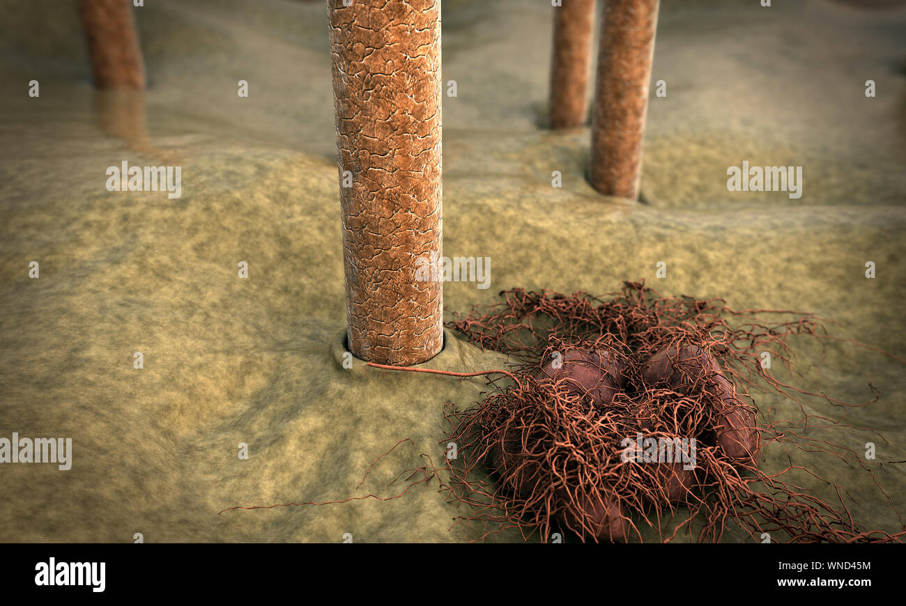 Image de la peau avec l'appareil photo, cheveux vole au-dessus de la surface de la peau, 3d illustration de cheveux, cheveux de tuer le champignon Banque D'Images