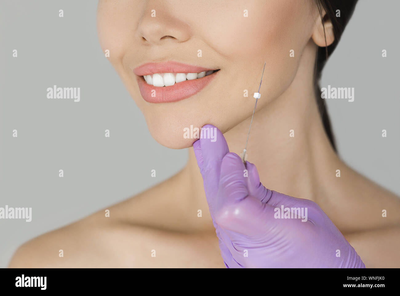 Esthétiques du visage cosmétique, mesothreads,technique de levage et le contourage face Banque D'Images