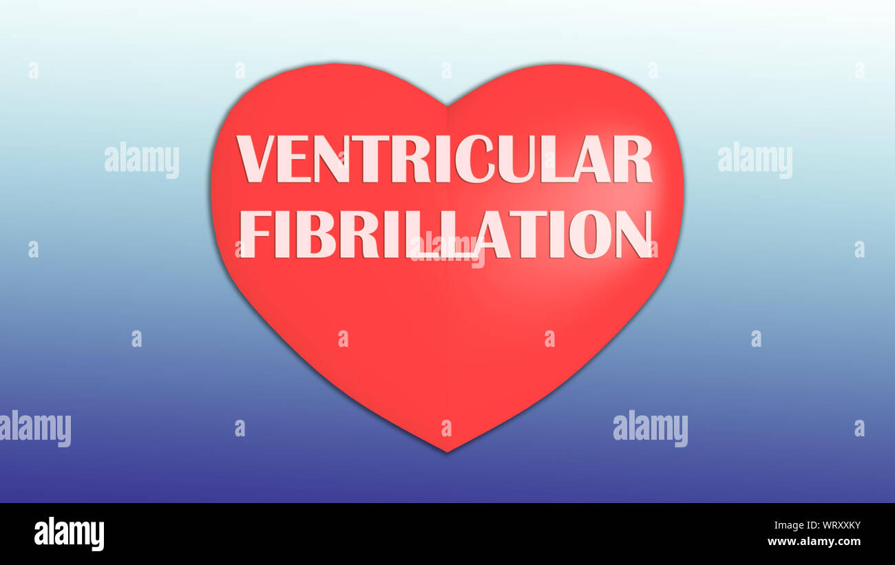 3D illustration de la fibrillation ventriculaire titre sur red heart, isolé sur dégradé bleu. Banque D'Images