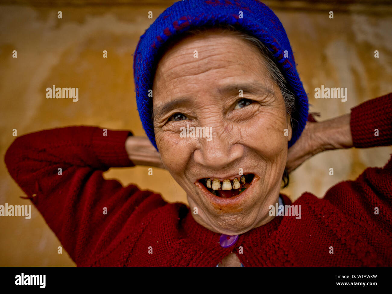 Femme avec dents tachées en raison de l'utilisation de la noix de bétel Banque D'Images