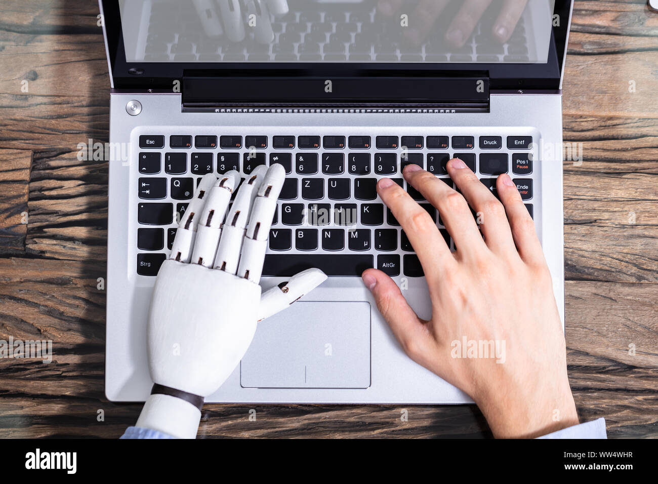 Homme avec prothèse de main travaillant sur ordinateur portable. Membre artificiel Banque D'Images