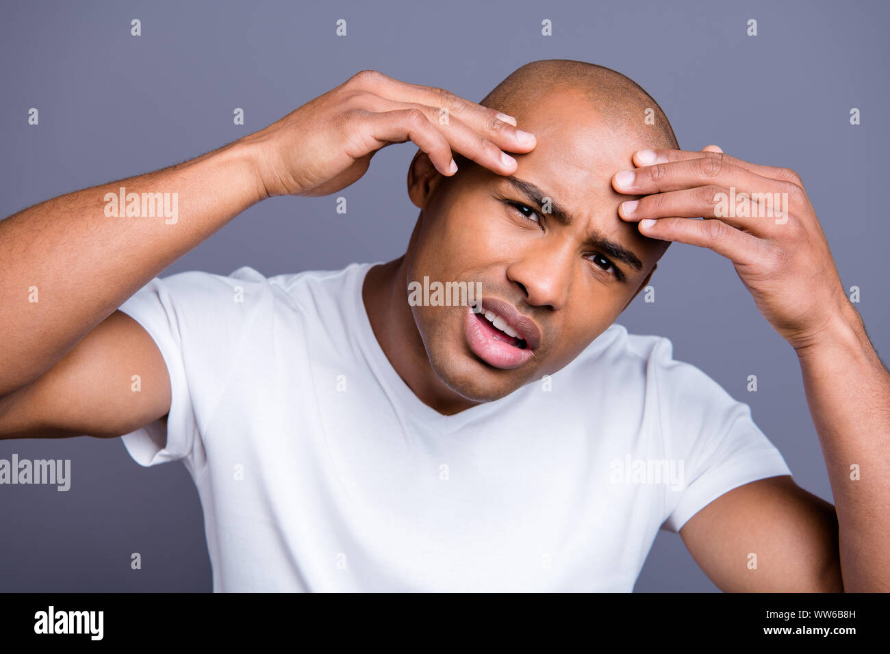 La photo en gros a souligné la peau noire il lui ses bras la peau l'expertise macho front irrité par l'action de l'Hydratant Crème anti de vieillissement wearing white t Banque D'Images