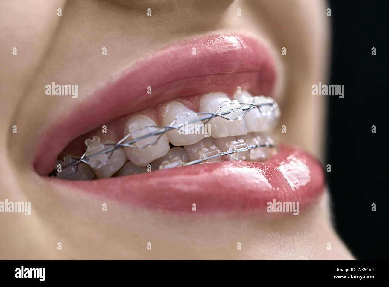 Superbe fille est montrant ses dents avec accolade dans une clinique dentaire. Horizontal macro photo. Banque D'Images