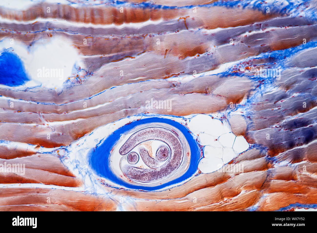 La trichine parasites dans le tissu de muscle 200x Banque D'Images