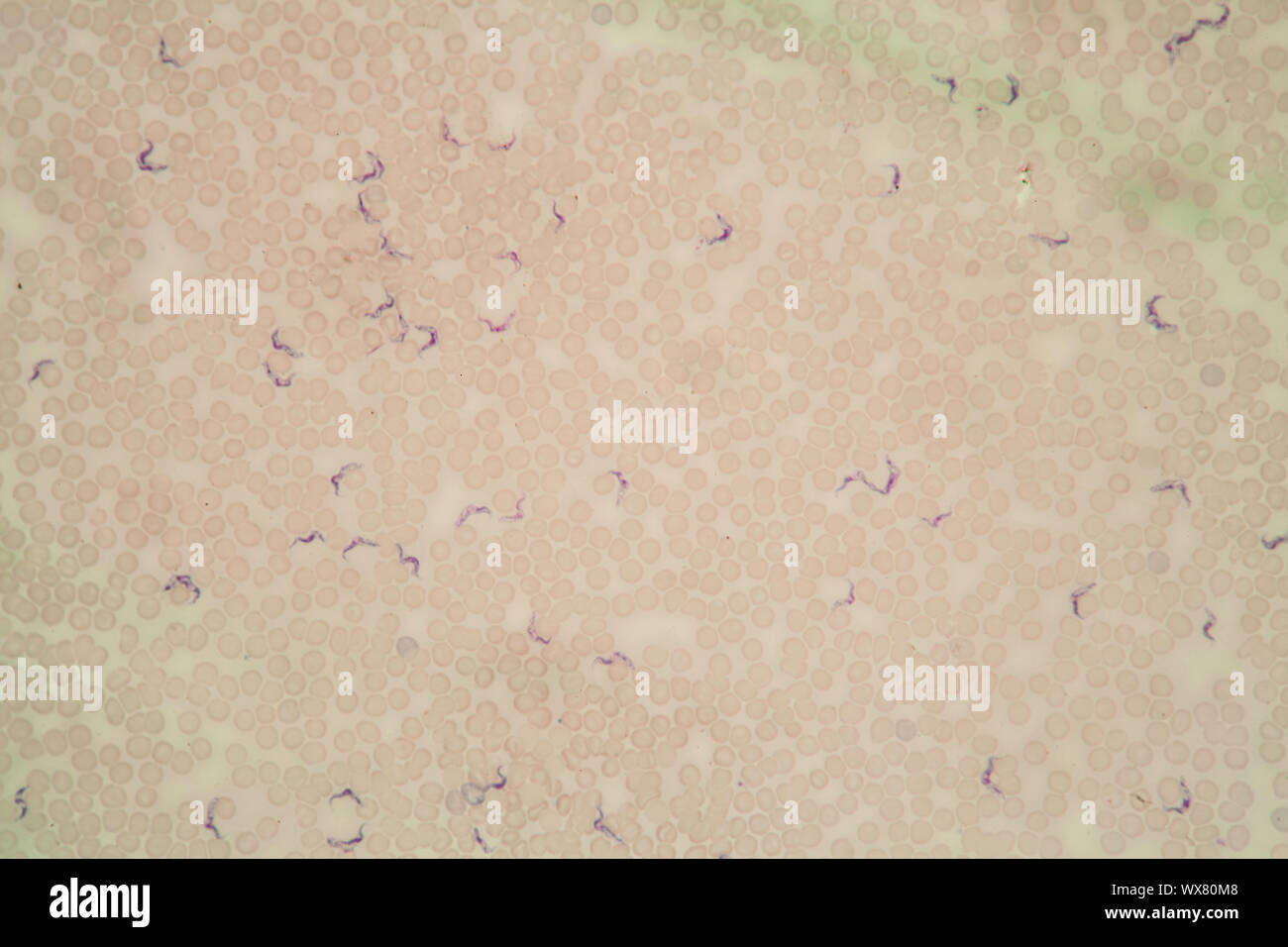 La maladie du sommeil au microscope des trypanosomes dans le sang 400x Banque D'Images