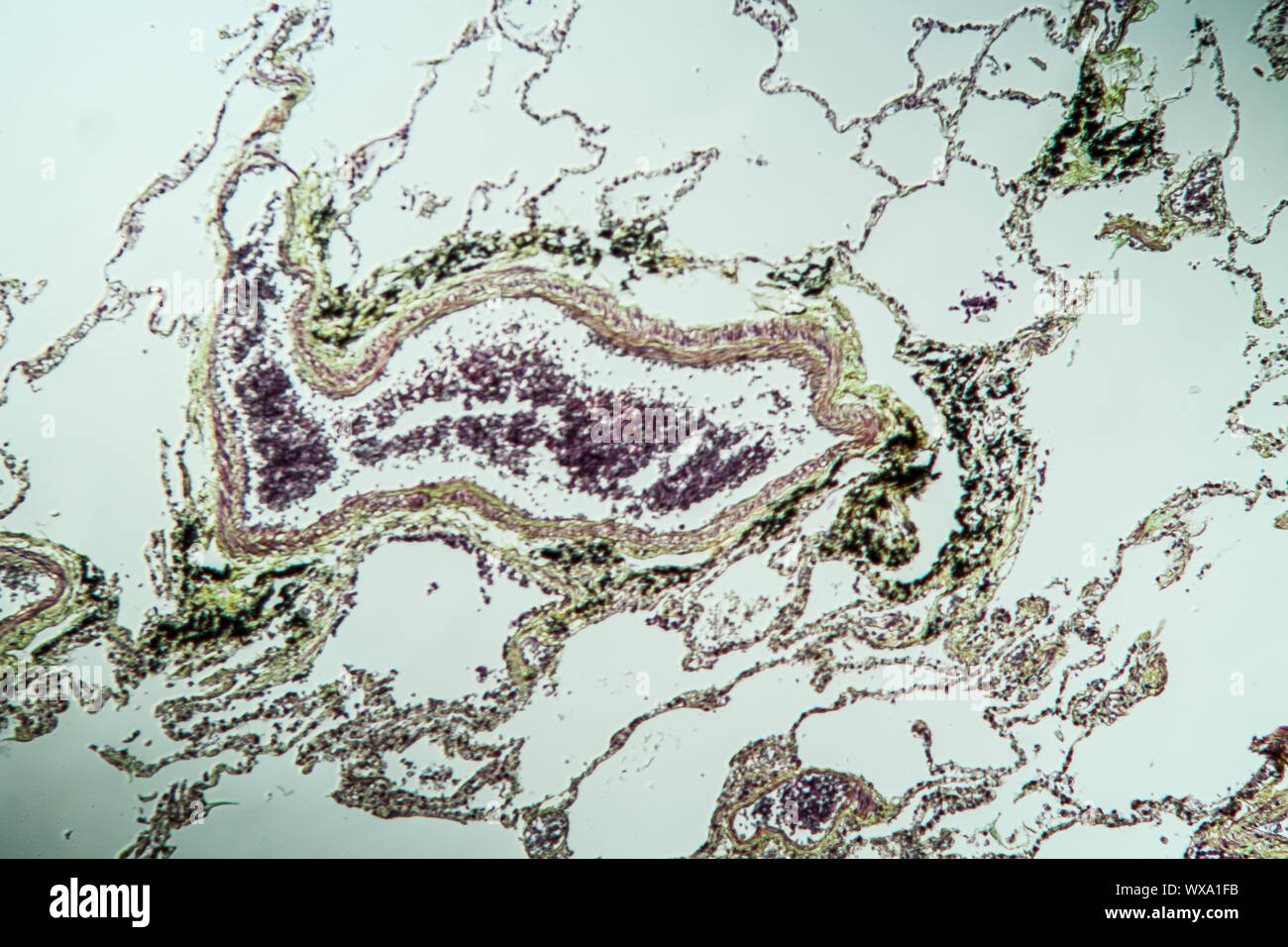 Les tissus pulmonaires sous le microscope 100x Banque D'Images